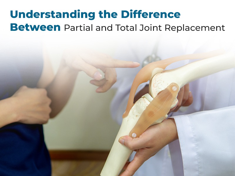 Understanding the Difference Between Partial and Total Joint Replacement
